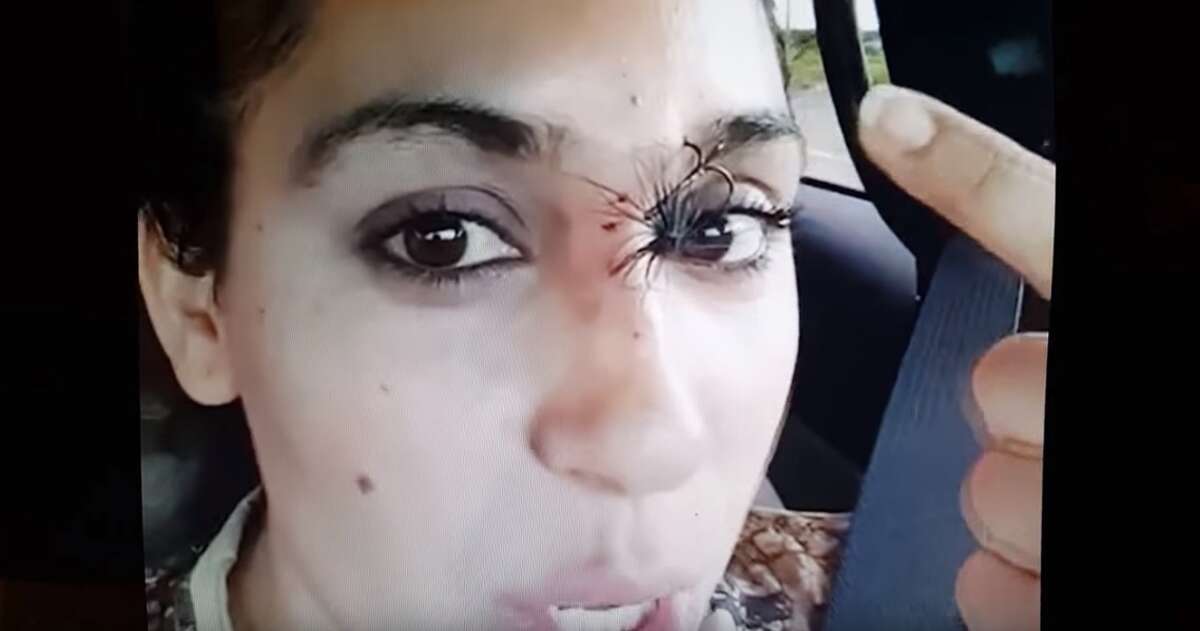 Texas mom, Vanessa Martinez, documented her experience after getting a hook stuck in her forehead while fishing in Laredo. 