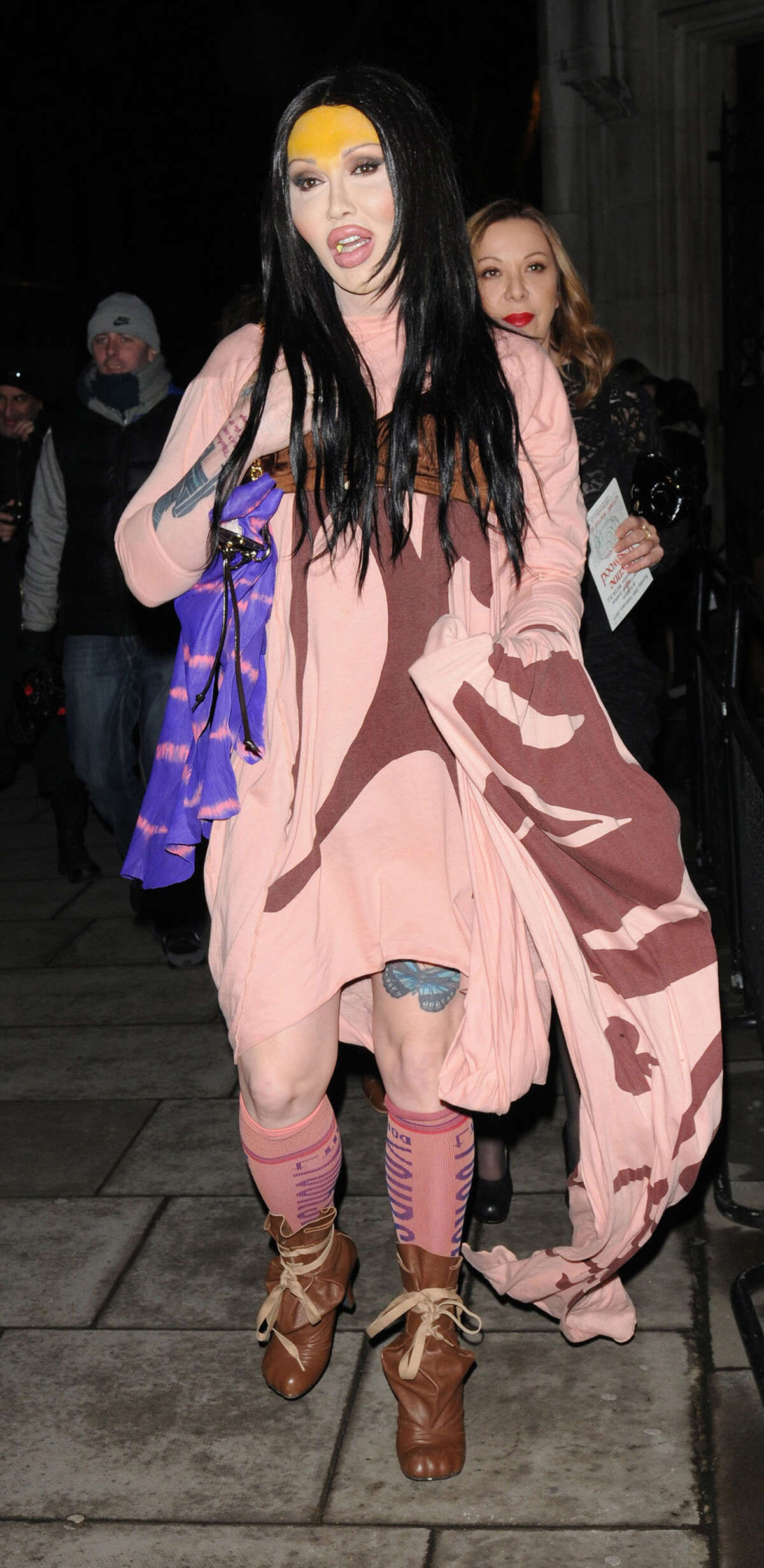 Pete Burns of Dead or Alive embodied glam lifestyle of the '80s, was a