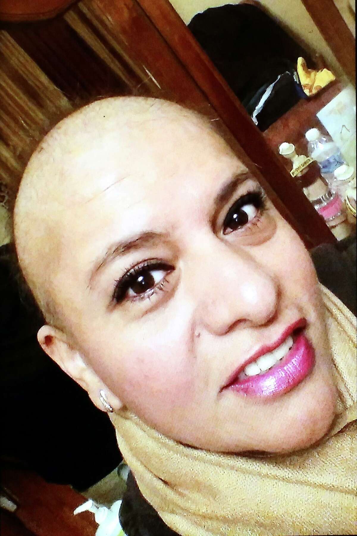 A photo of Lilia Rios after she lost her hair due to chemotherapy for breast cancer last year.