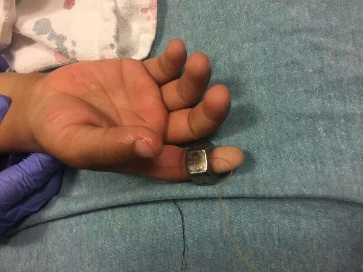Stamford firefighters remove steel nut from child's finger