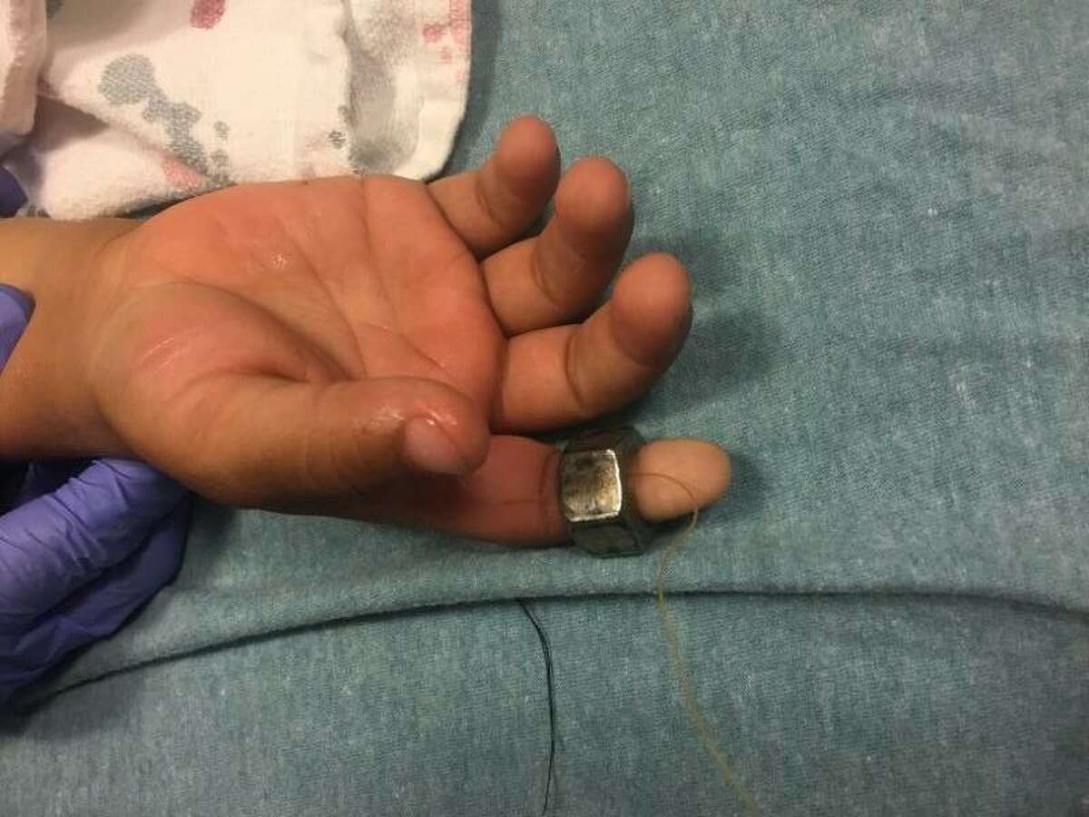 Bridgeport firefighters rescue finger from ring