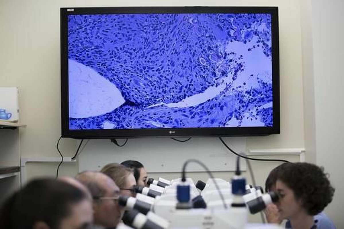 In this Thursday, Nov. 10, 2016 photo, CDC workers look through microscopes at as an image of a skin biopsy is displayed on a screen at the Centers for Disease Control and Prevention in Atlanta. On Monday, Dec. 5, 2016, the nation's top public health agency issued a frank assessment of its recent battles against prioritized health problems, finding progress in some areas but backslide in others. Despite the mixed grades in the CDC’s report card on itself, some experts applauded CDC efforts, saying the agency had only limited abilities to prevent illness or stop people from doing things that hurt their own health. (AP Photo/Branden Camp)