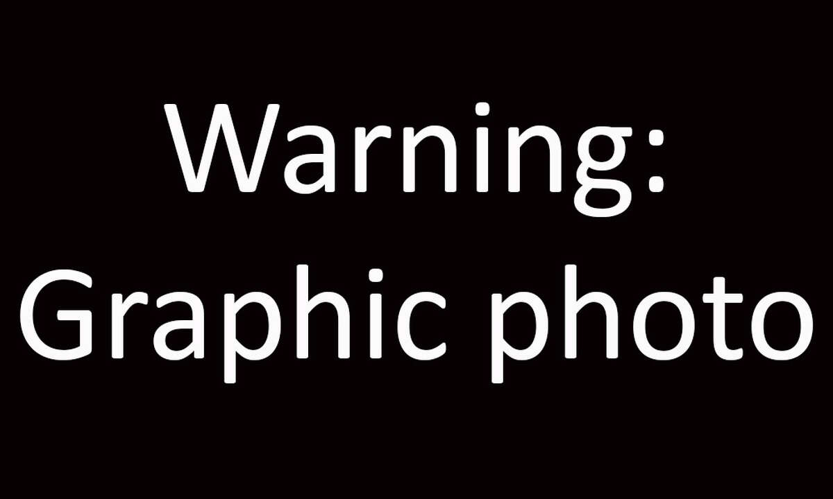 Warning graphic photo