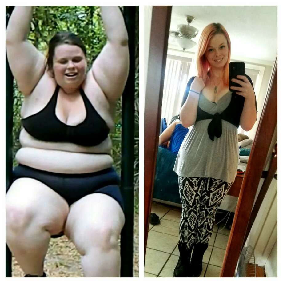 Photos Woman Loses 193 Pounds Shares Ugly Reality Of