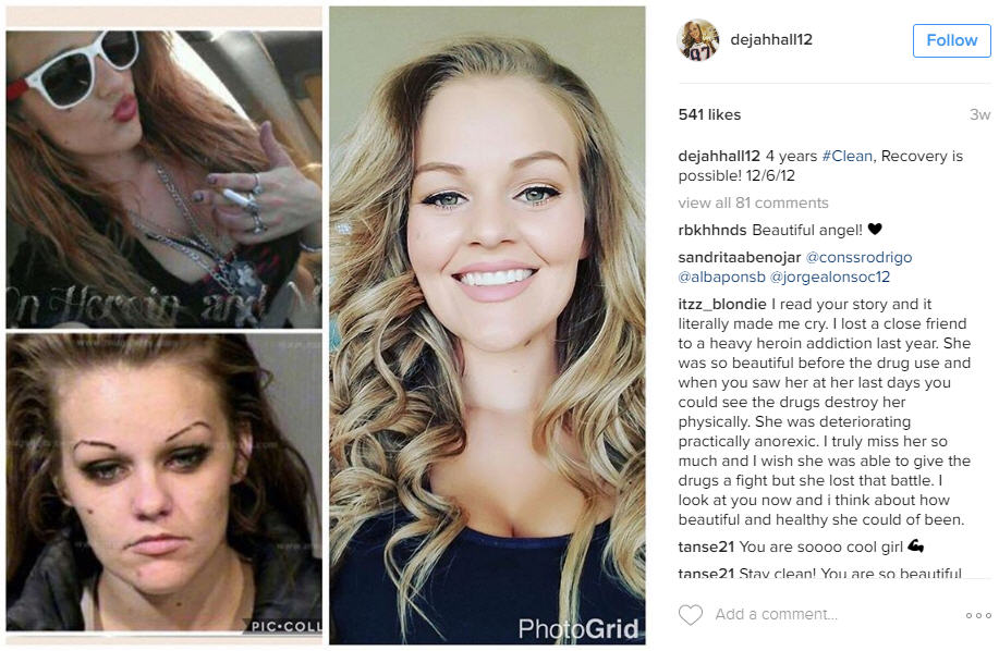 Former Drug Addicts Share Their Recovery Photos On Social Media