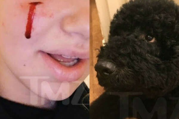 Presidential Dog Bite Sunny Injures A White House Guest Sfchronicle Com