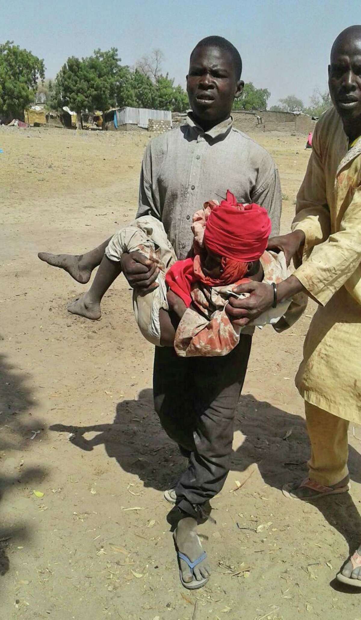 In this image supplied by MSF, a man carries an injured child following a military air strike at a camp for displaced people in Rann, Nigeria, Tuesday Jan. 17, 2017. Relief volunteers are believed to be among the more than 100 dead after a Nigerian Air Force jet fighter mistakenly bombed the refugee camp, while on a mission against Boko Haram extremists. Medical condition of the child unknown. (Medecins Sans Frontieres (MSF) via AP)