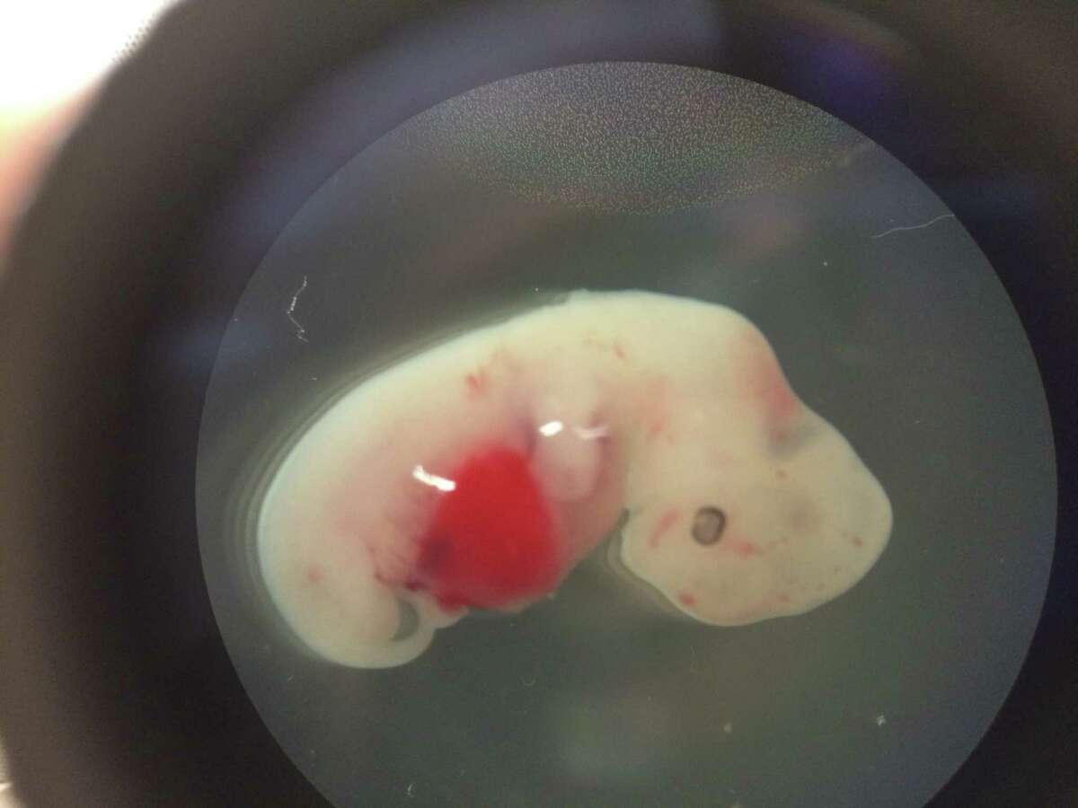 This undated photo provided by the Salk Institute on Jan. 24, 2017 shows a 4-week-old pig embryo which had been injected with human stem cells. The experiment was a very early step toward the possibility of growing human organs inside animals for transplantation. (Salk Institute via AP) ORG XMIT: NY925