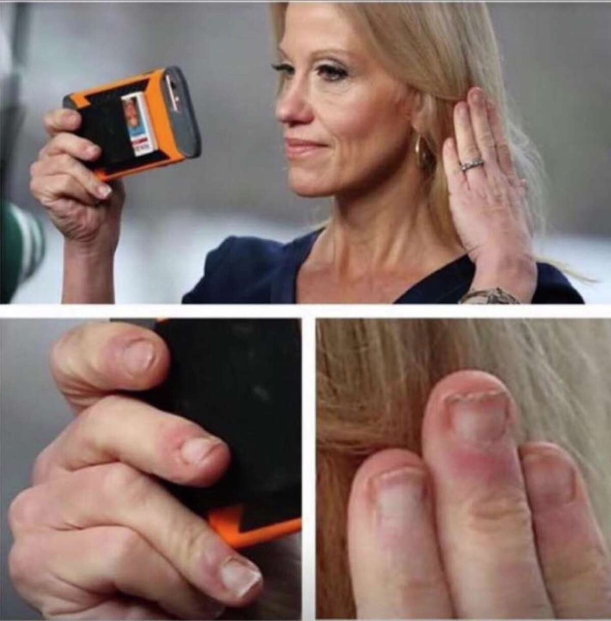 Instagram takes aim at Kellyanne Conway's nails
