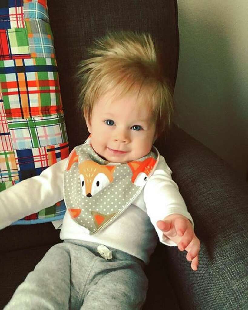 Adorable Baby Born With Full Head Of Hair Is Stopping People In