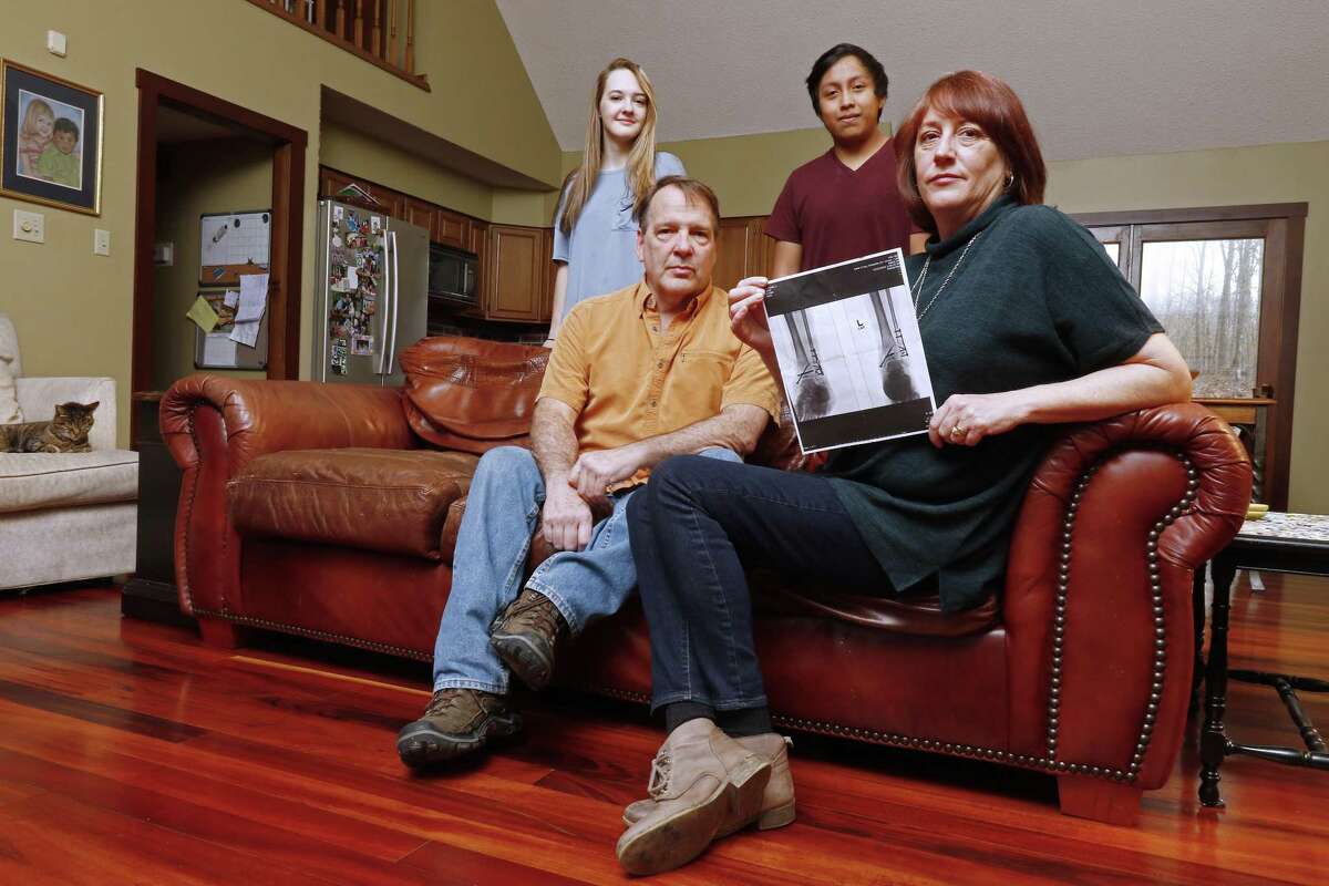 Leslie Kurtz (right) — shown with her husband, Bart Bartram, daughter Rainey, and son Rio — holds a print of an X-ray of her ankle. Leslie Kurtz needed three plates, eight screws and a big assist from her insurer after breaking every bone in her ankle during a whitewater rafting accident in 2015. But that protection may not exist next year because insurers have abandoned her exchange.