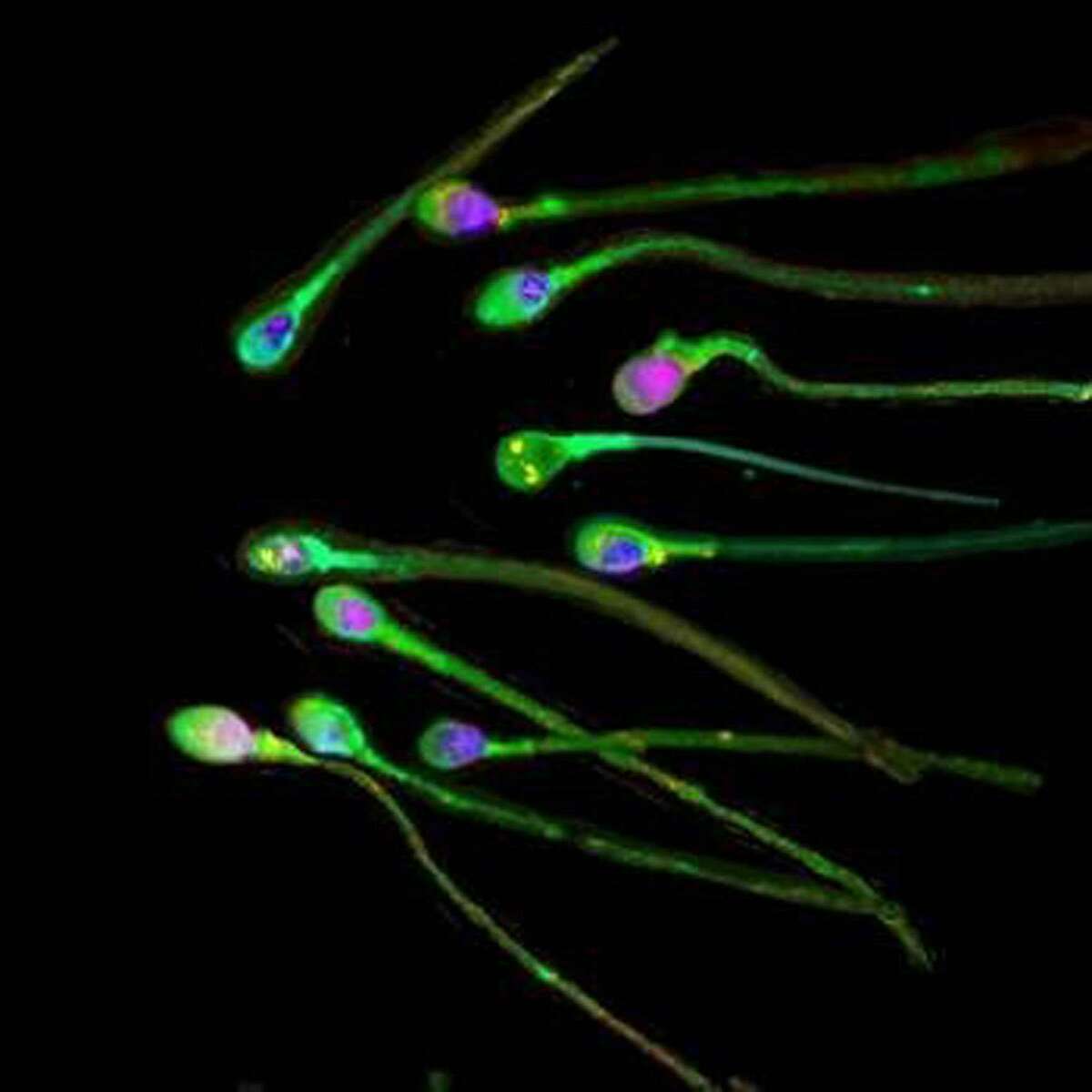 This a a handout image from The Journal of Science of human sperm. (AP Photo/PA, Journal of Science, HO)