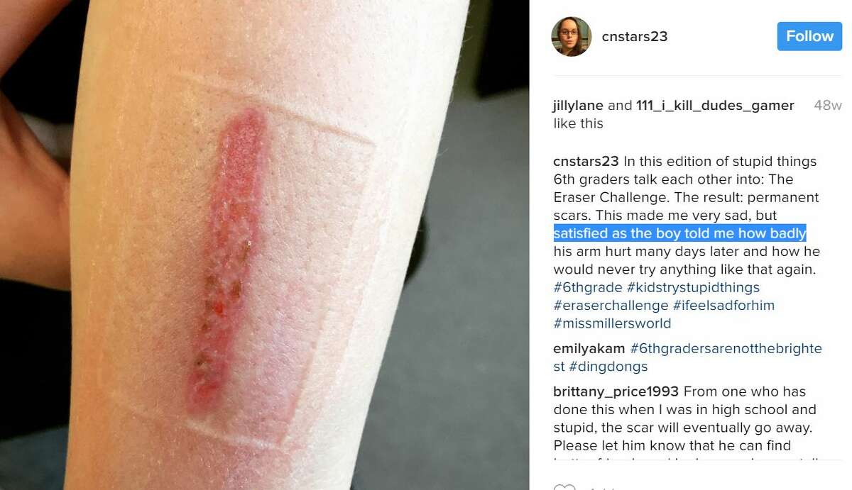 Be on the lookout for 'eraser challenge' a new and disturbing social