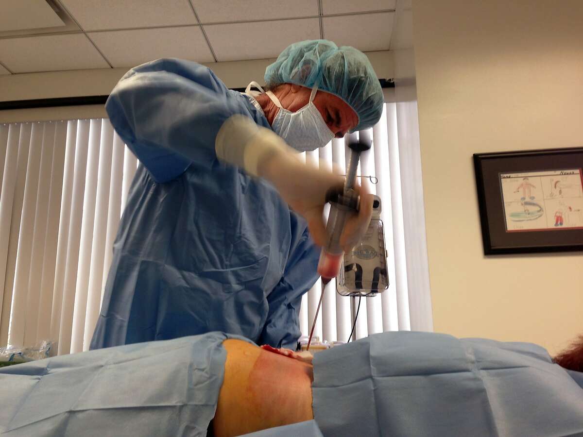 In this Dec. 5, 2014 photo, Dr. Mark Berman, of the Cell Surgical Network, collects fat from a patient’s back as the part of an experimental stem cell procedure, in Beverly Hills, Calif. Berman’s company is the largest in the mushrooming industry of for-profit clinics that market stem cells to patients with dozens of different diseases and conditions. Critics say the businesses have flourished due to a lack of government oversight. (AP Photo/Raquel Maria Dillon)