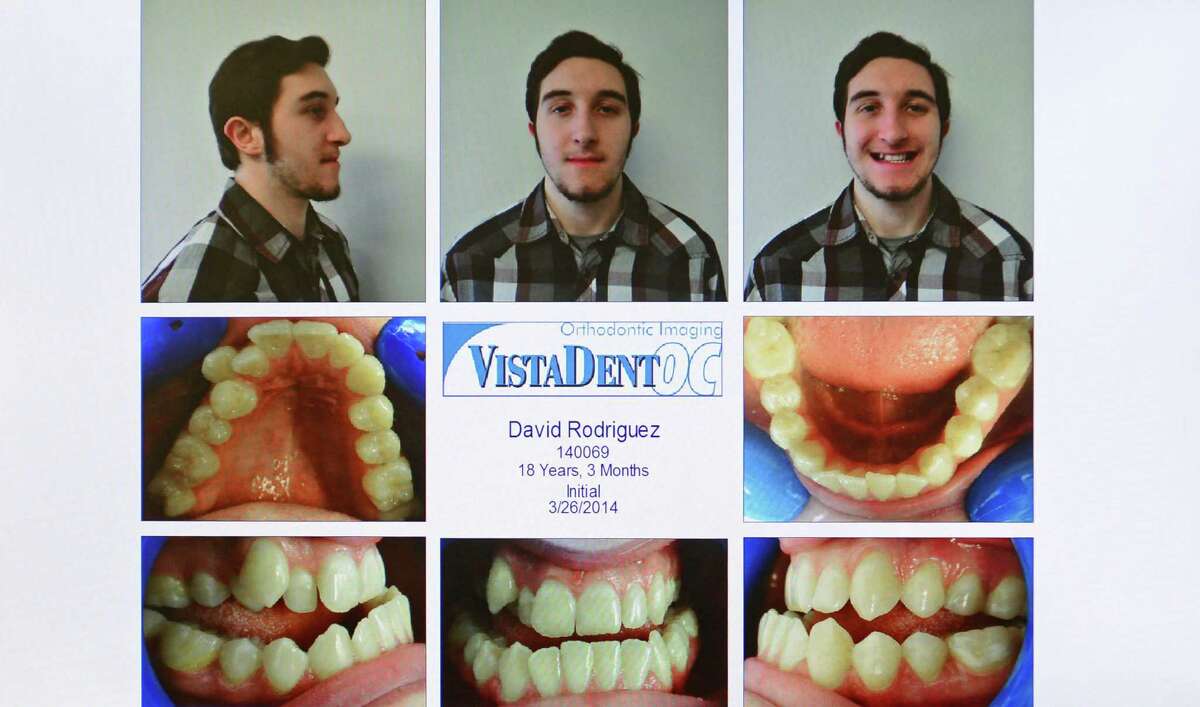 Surgery delivers new smile for Norwalk man