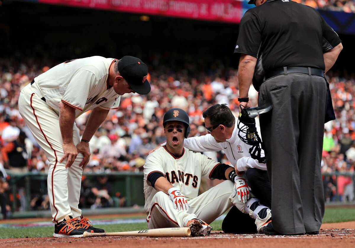 Giants' Buster Posey goes down after being hit by a pitch by Arizona's Taijuan Walker in the first inning, as the San Francisco Giants take on the Arizona Diamondbacks in their home opener against the at AT&T Park in San Francisco, Calif. on Mon. April 10, 2017.