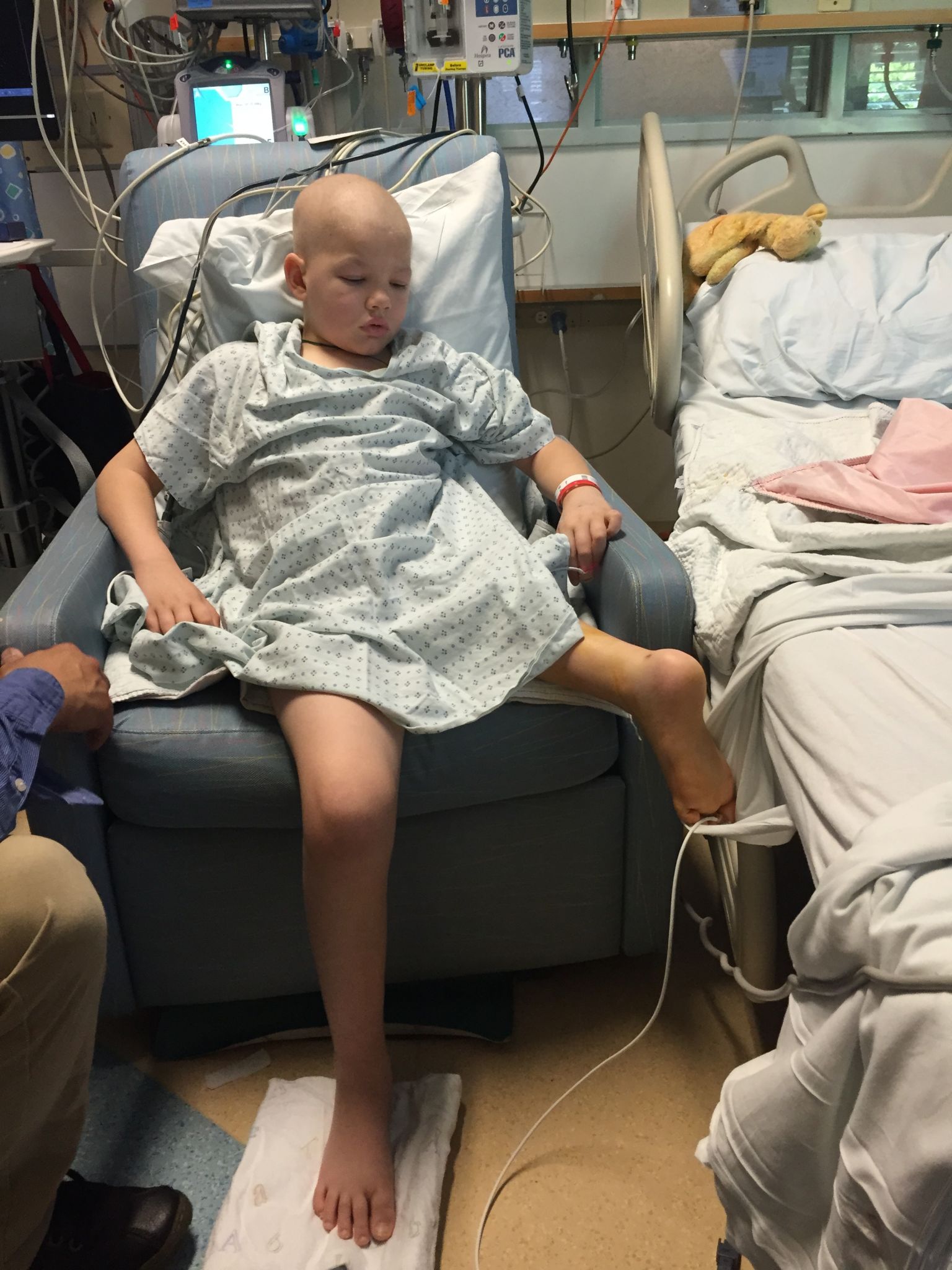 After rare surgery at Stanford, a 10-year-old amputee gets back on the basketball ...1536 x 2048