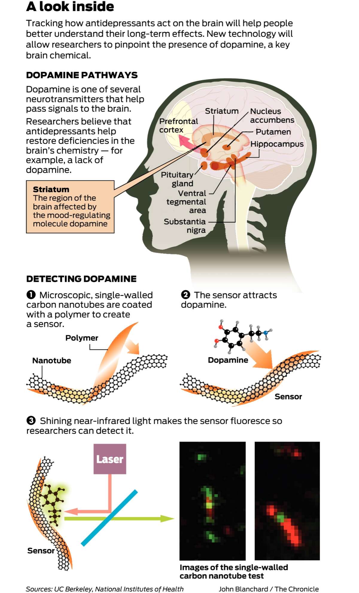 Shedding Light On How Antidepressants Affect The Brain