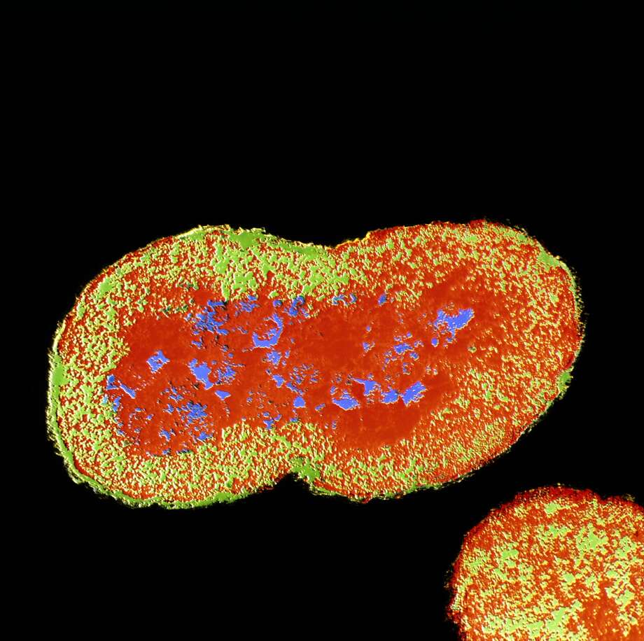 Mutant drug-resistant super gonorrhea strain could make 