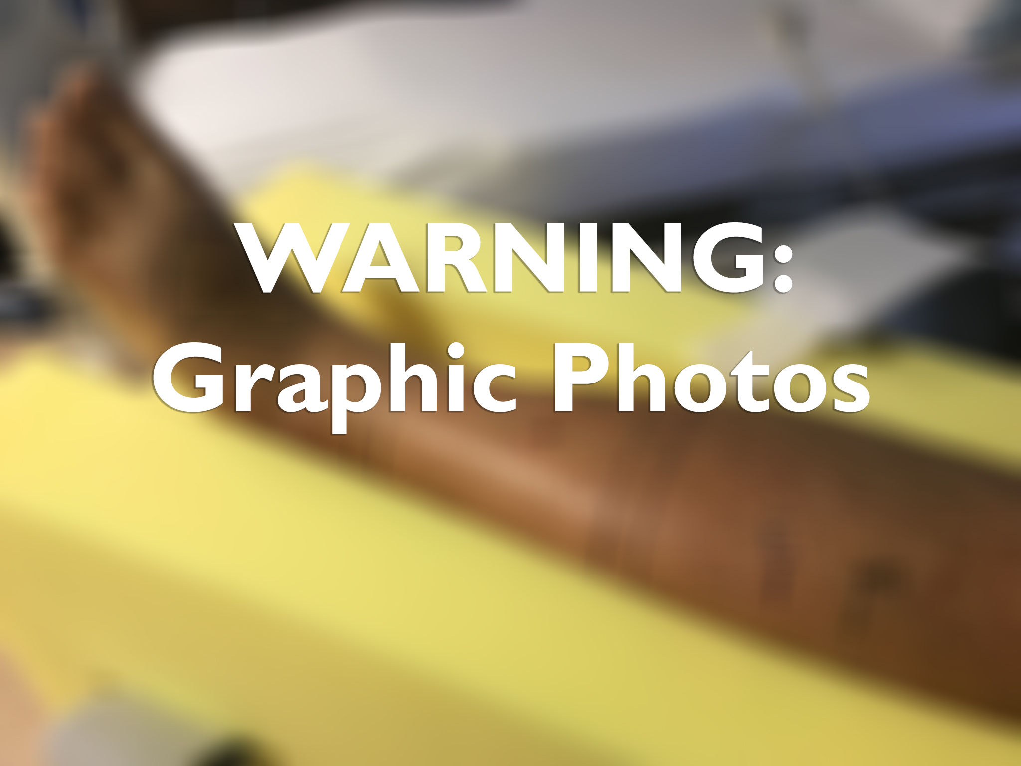 Copperhead snakes take multiple bites out of North Texas man