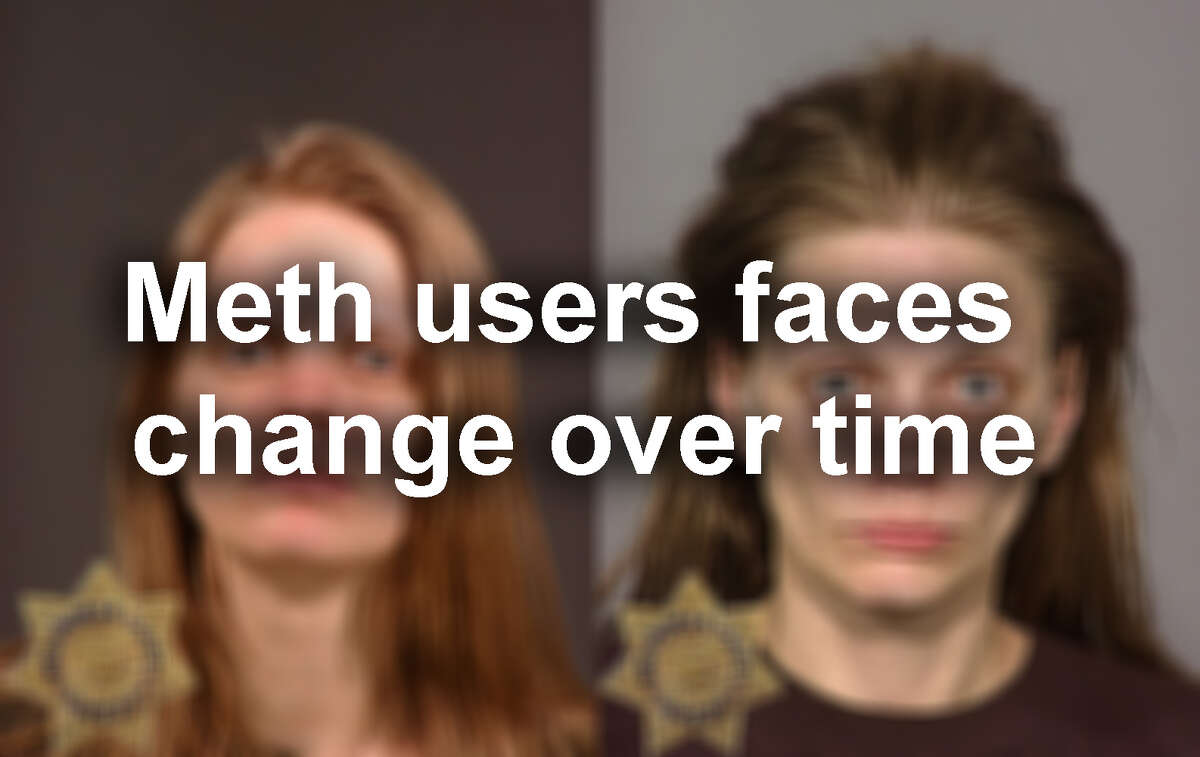 Click through our gallery of mugshots of people before and after they used meth...