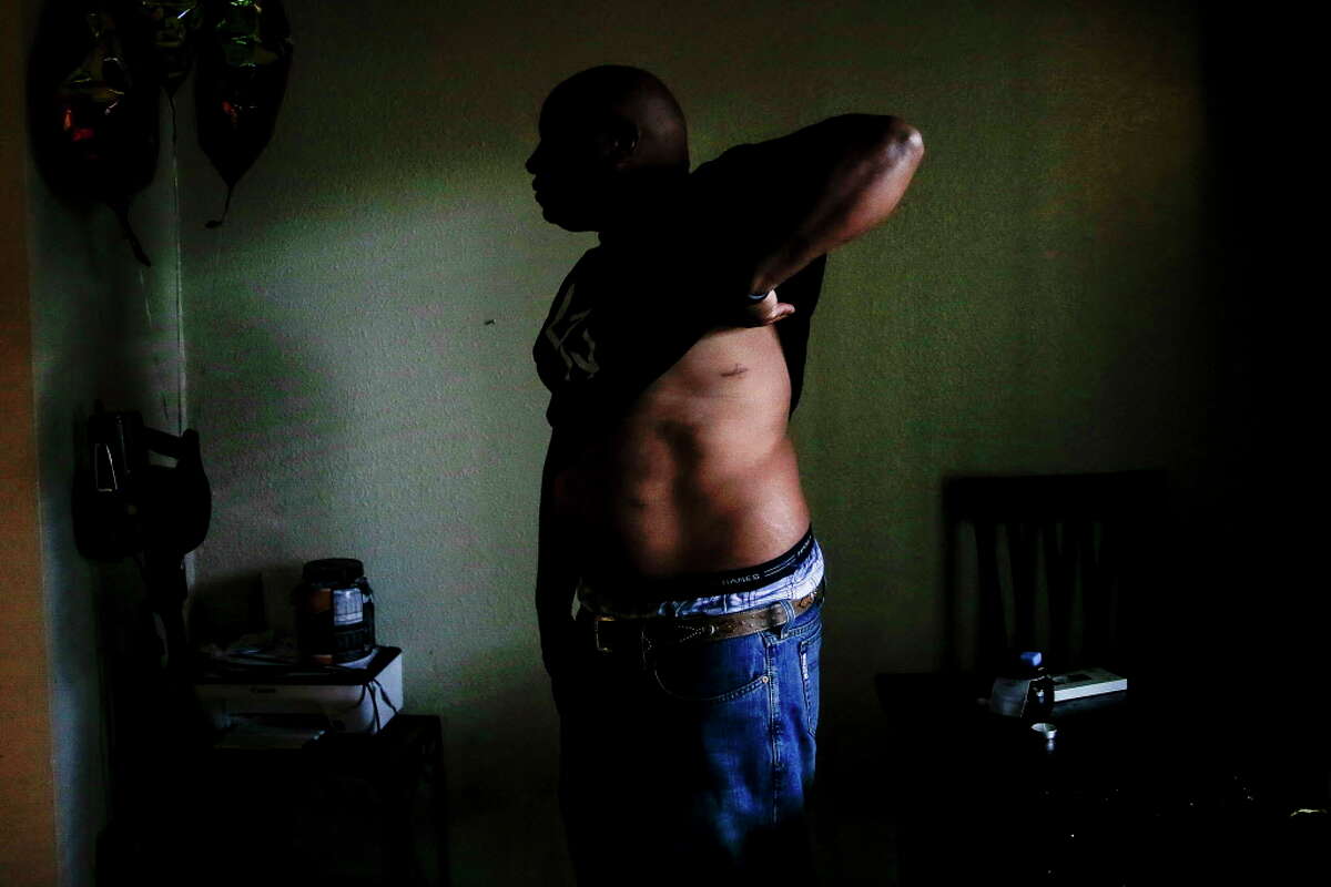 Reginald Rossow lifts his shirt to show his scars in his apartment Tuesday, June 13, 2017 in Clute. Rossow was shot through his apartment wall while he was sleeping by an off duty police officer who was living in the apartment next to his.