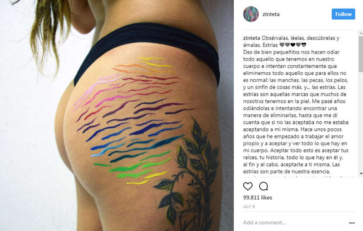 This Artist Transforms Stretch Marks Into Stunning Works Of Art