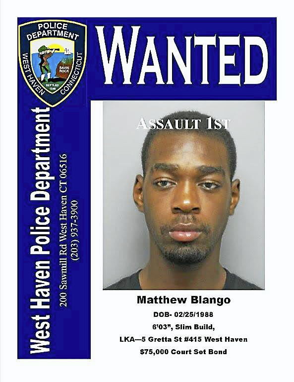 West Haven police seek suspect in ‘serious assault’