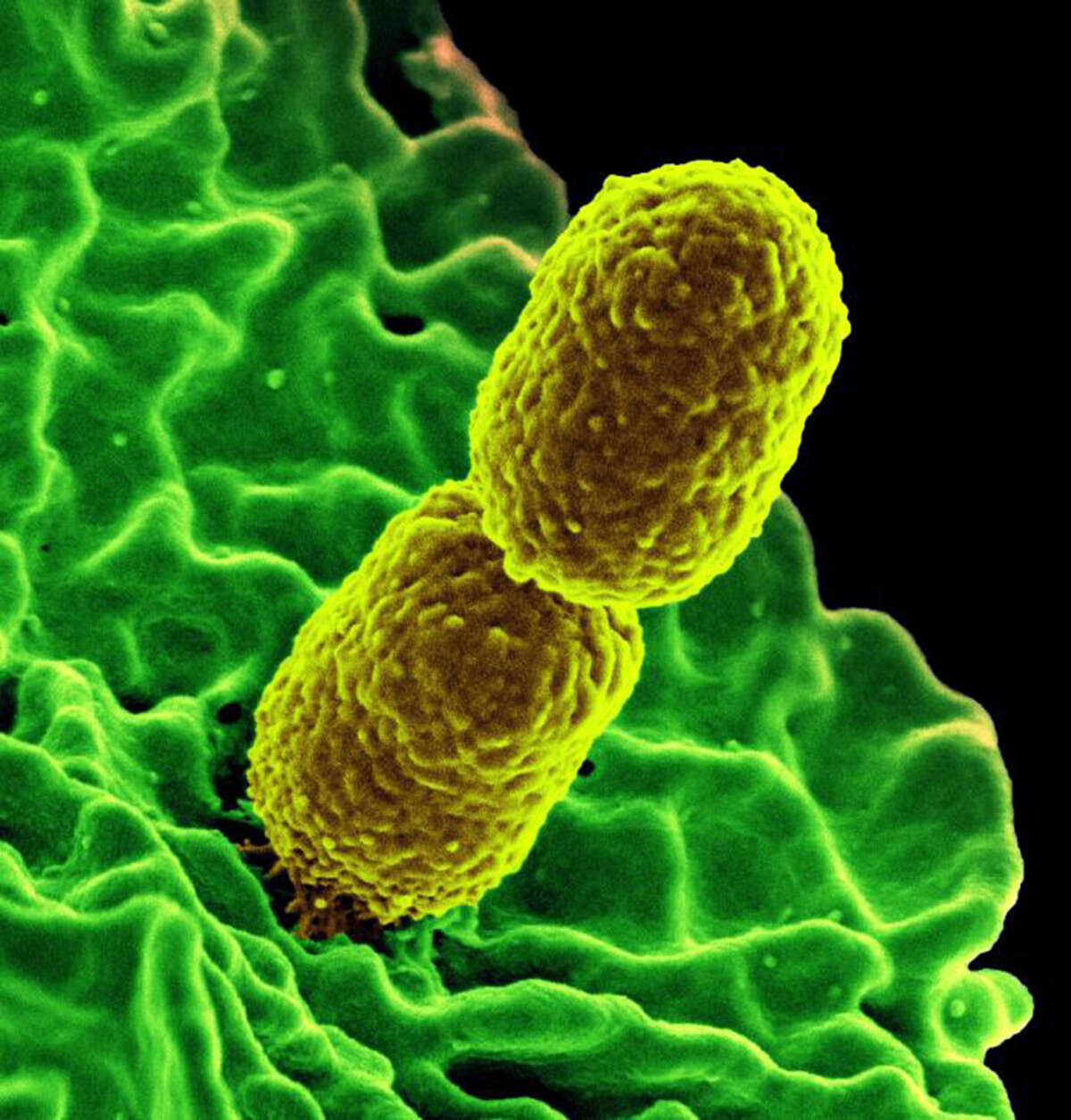 Two mustard-colored, rod-shaped carbapenem-resistant Klebsiella pneumonias bacteria are part of the family of germs known as Enterobacteriaceae. (Handout photo by National Institute of Allergy and Infectious Diseases)