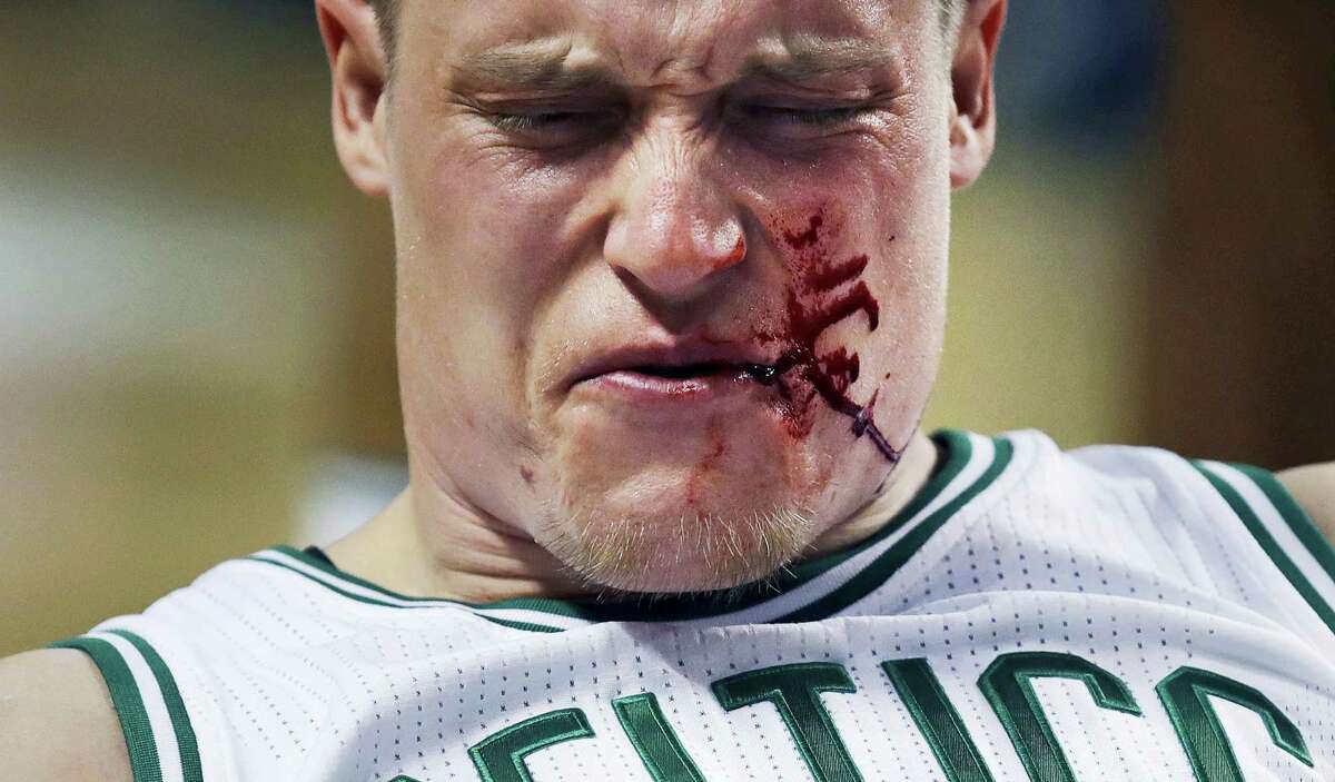 Boston Celtics forward Jonas Jerebko reacts after being hit by Houston Rockets guard James Harden during the fourth quarter. Harden was charged with a flagrant foul. The Celtics defeated the Rockets 120-109.