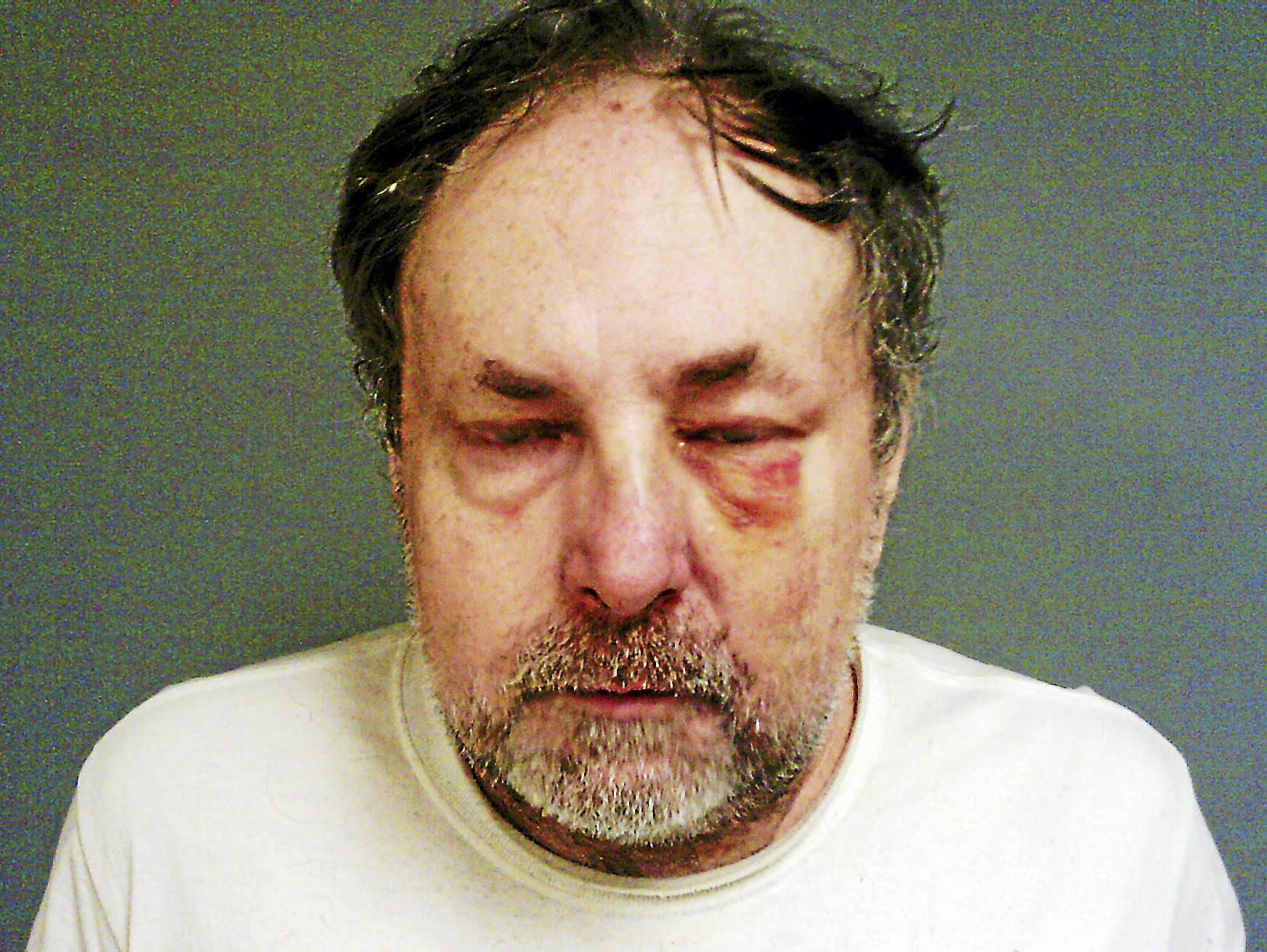 State police: Man went wrong way on Route 8, crashed into police cars ...