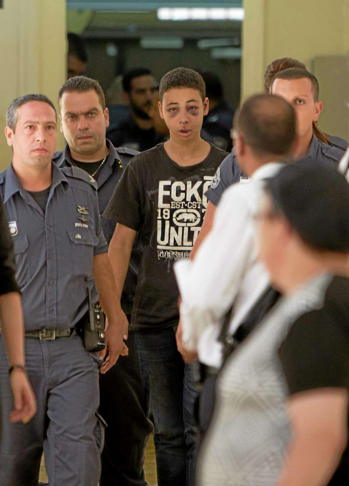 Tariq Abu Khdeir, 15, a Palestinian-American who relatives say was beaten and arrested by Israeli police during clashes sparked by the killing Thursday of his cousin Mohammed Abu Khdeir, is escorted by Israeli prison guards during an appearance at Jerusalem magistrate's court Sunday, July 6, 2014. Israeli police said Tariq Abu Khdeir resisted arrest, attacked officers and was carrying a slingshot for lobbing stones when he was arrested. He has been sentenced to nine days of house arrest. The U.S. State Department said it was "profoundly troubled" by reports of his beating and demanded an investigation. (AP Photo/Oded Balilty)