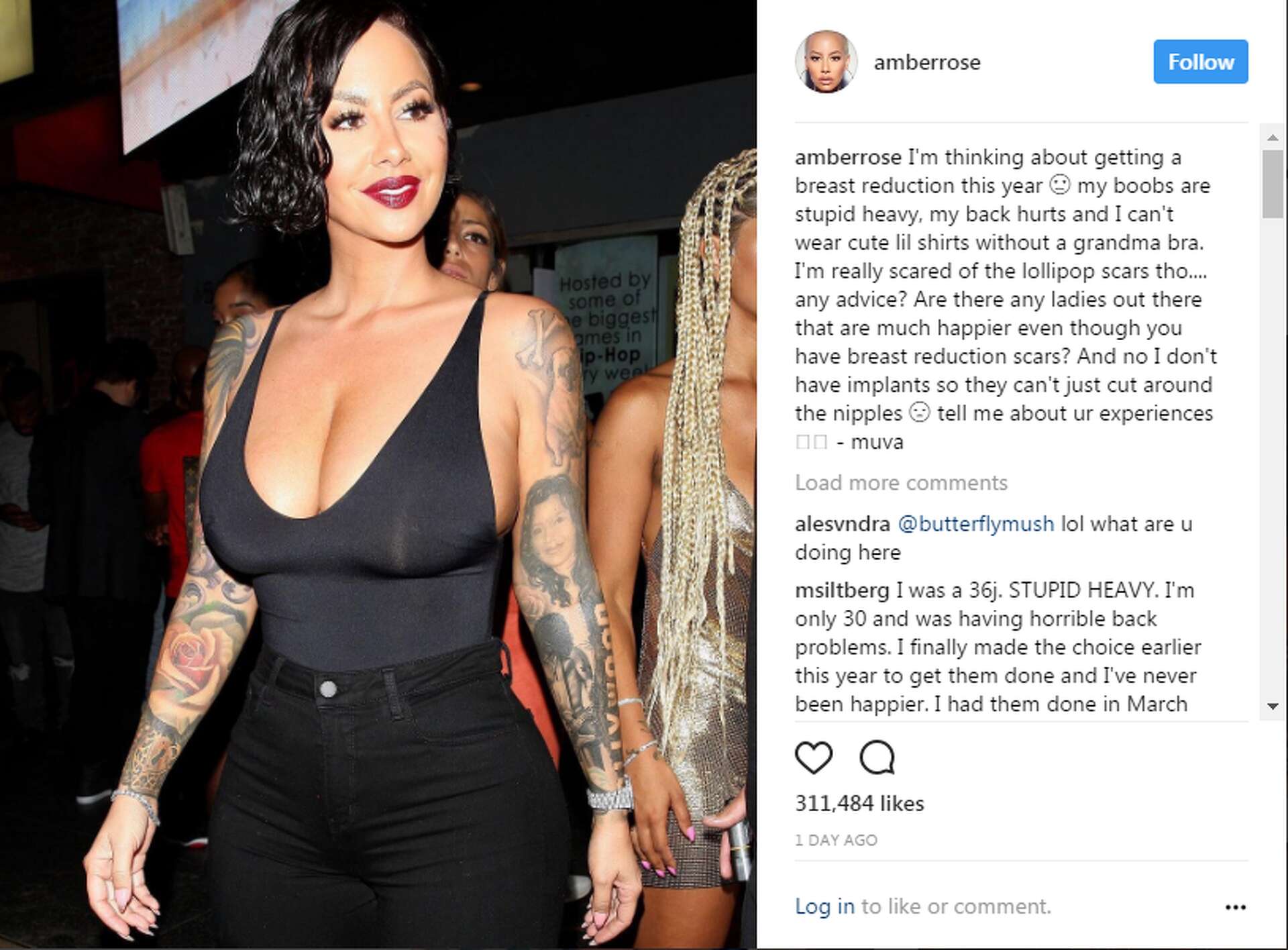 Amber Rose wants a breast reduction, asks Instagram followers for advice