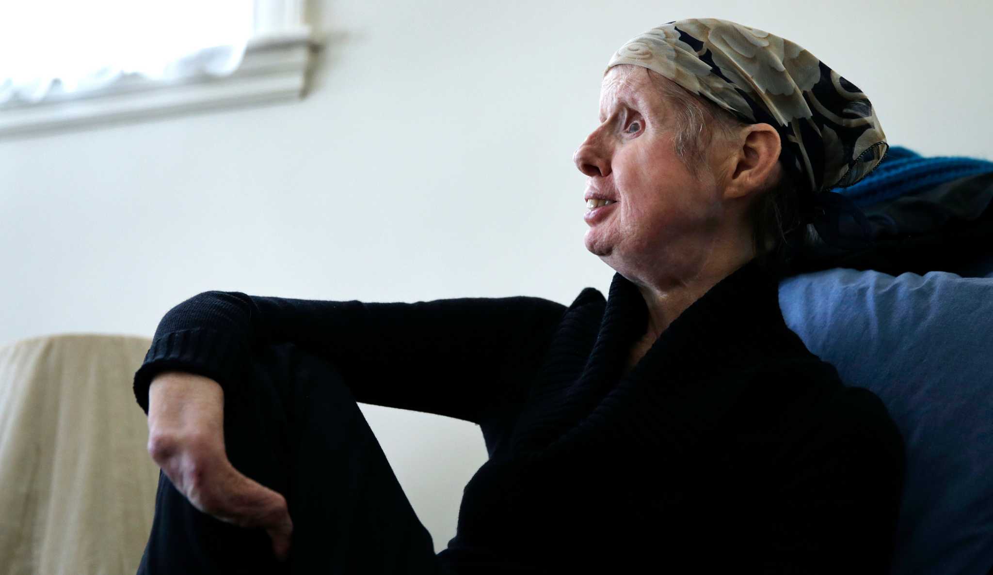 20150310 Charla Nash