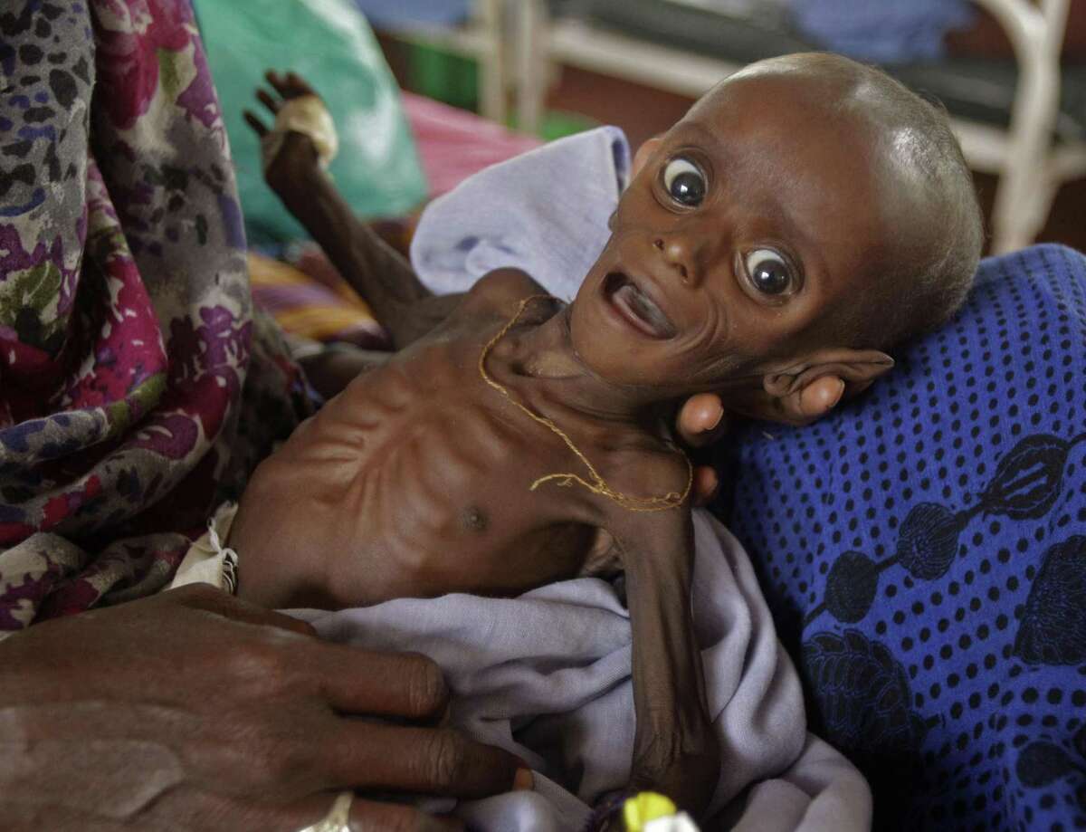A 7-month-old child who is starving is held by his mother in a field hospital of the International Rescue Committee in Dadaab, Kenya. A reader says such children deserve our prayers.