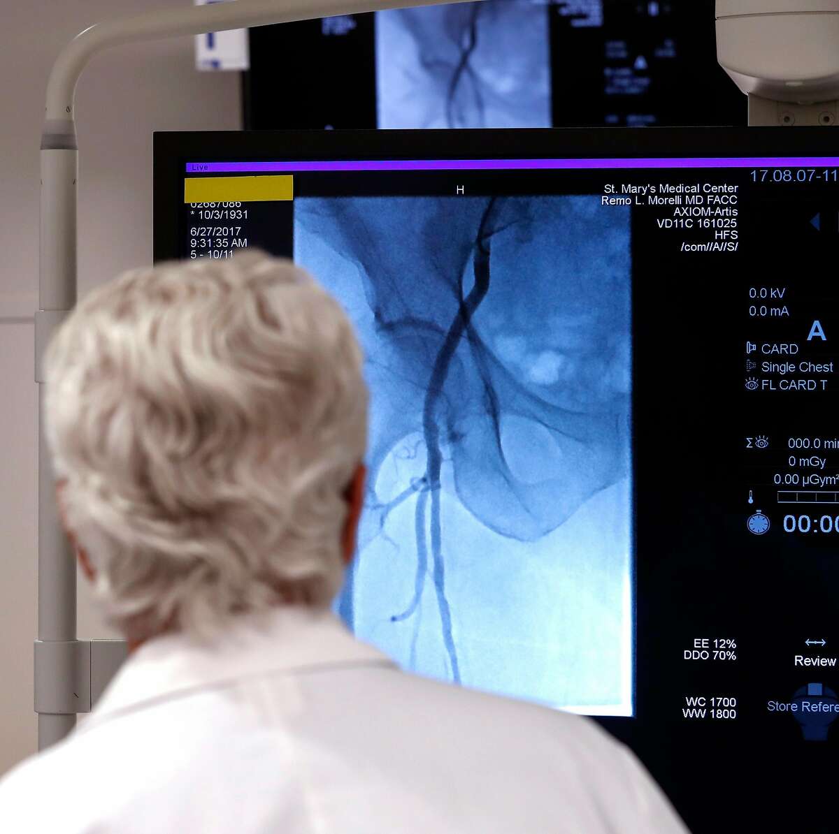 Dr. Robert Murray, chief medical officer at St. Mary's with a cardiovascular x-ray that shows a patient's leg vessels on screen in the control room at the cardiology laboratory at St. Mary's Medical Center in San Francisco, Ca., on Mon. August 7, 2017. Cardiology is one of a handful of practice areas where UCSF will be taking its resources and bringing it over to Dignity.