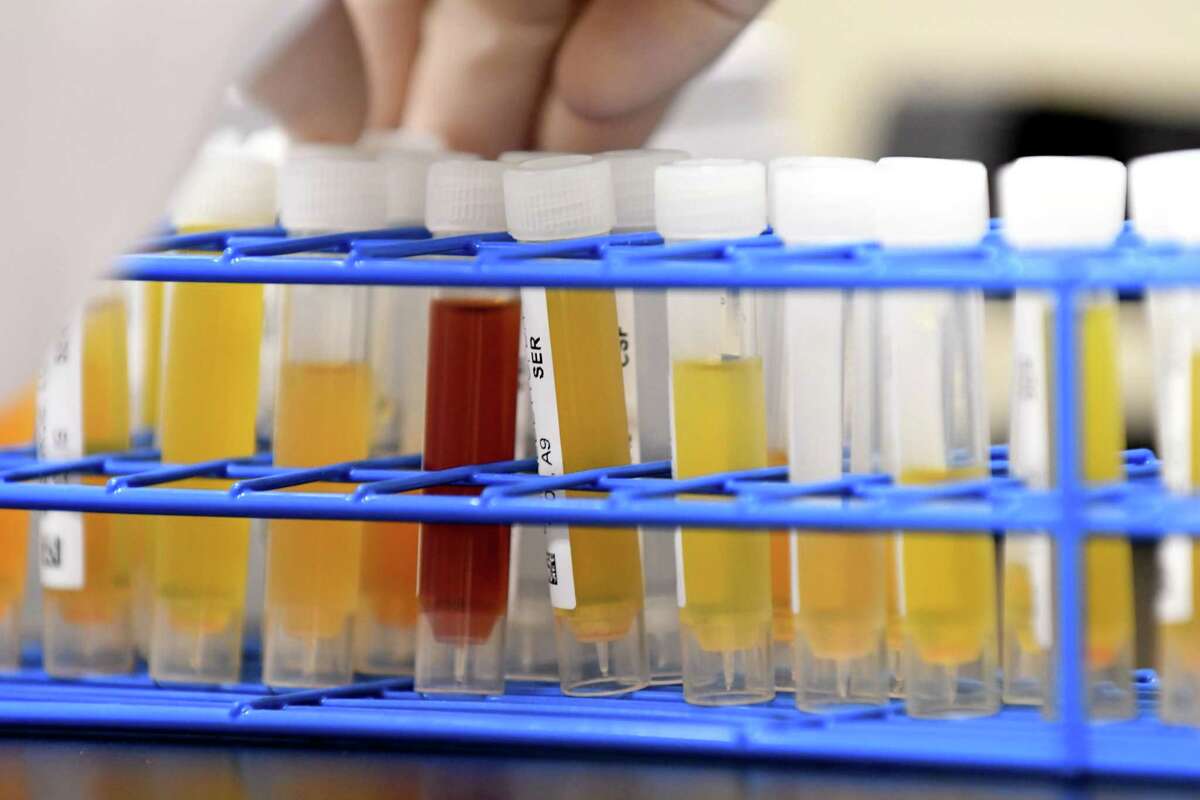 Albany scientists do detective work to identify tickborne Powassan