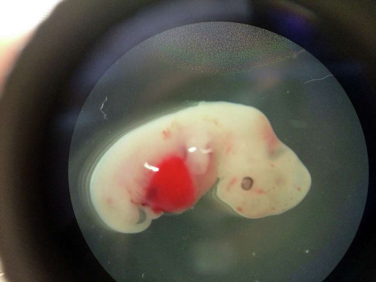 This undated photo provided by the Salk Institute on Jan. 24, 2017, shows a 4-week-old pig embryo which had been injected with human stem cells. The experiment was a very early step toward the possibility of growing human organs inside animals for transplantation.