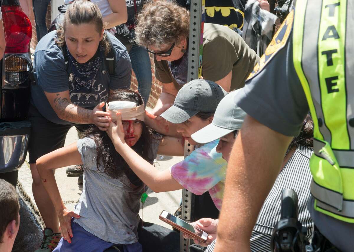 People receive first-aid after a car accident ran into a crowd of protesters in Charlottesville, VA on August 12, 2017. A picturesque Virginia city braced Saturday for a flood of white nationalist demonstrators as well as counter-protesters, declaring a local emergency as law enforcement attempted to quell early violent clashes. / AFP PHOTO / PAUL J. RICHARDS (Photo credit should read PAUL J. RICHARDS/AFP/Getty Images)