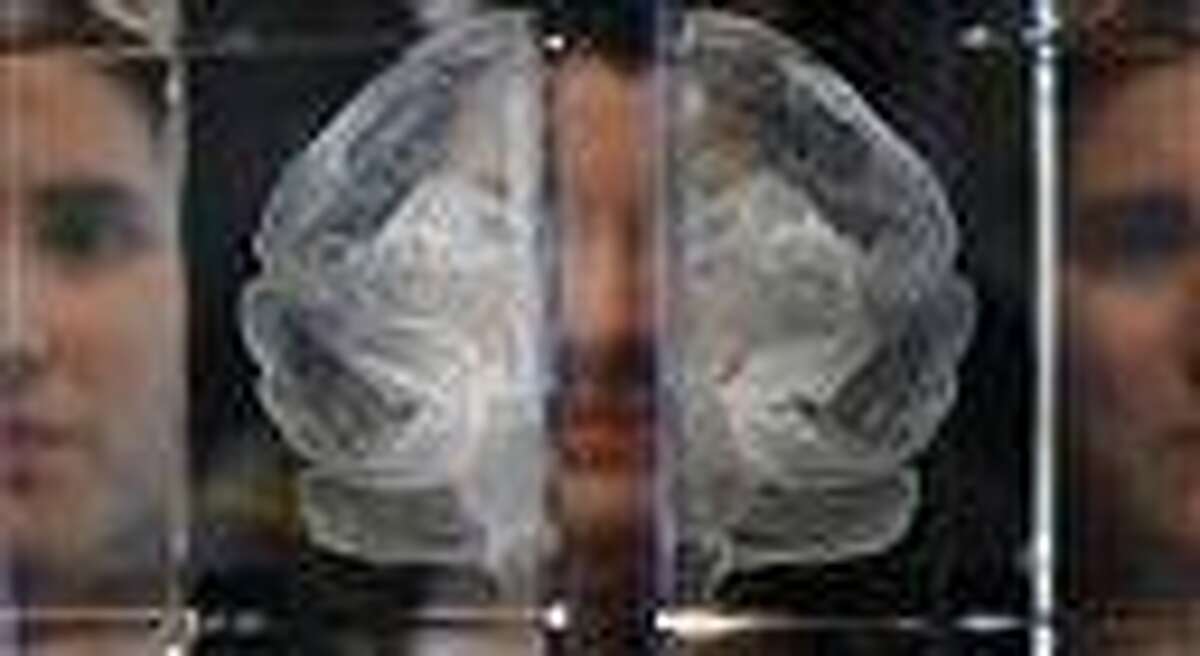 Wellcome Trust employee Zoe Middleton poses Tuesday for the media by a work entitled 'My Soul' by artist Katherine Dawson, that is a laser etched in lead crystal glass of the artist's own MRI scan, at an exhibition call 'Brains -The Mind as Matter' at the Wellcome Collection in London. Associated Press