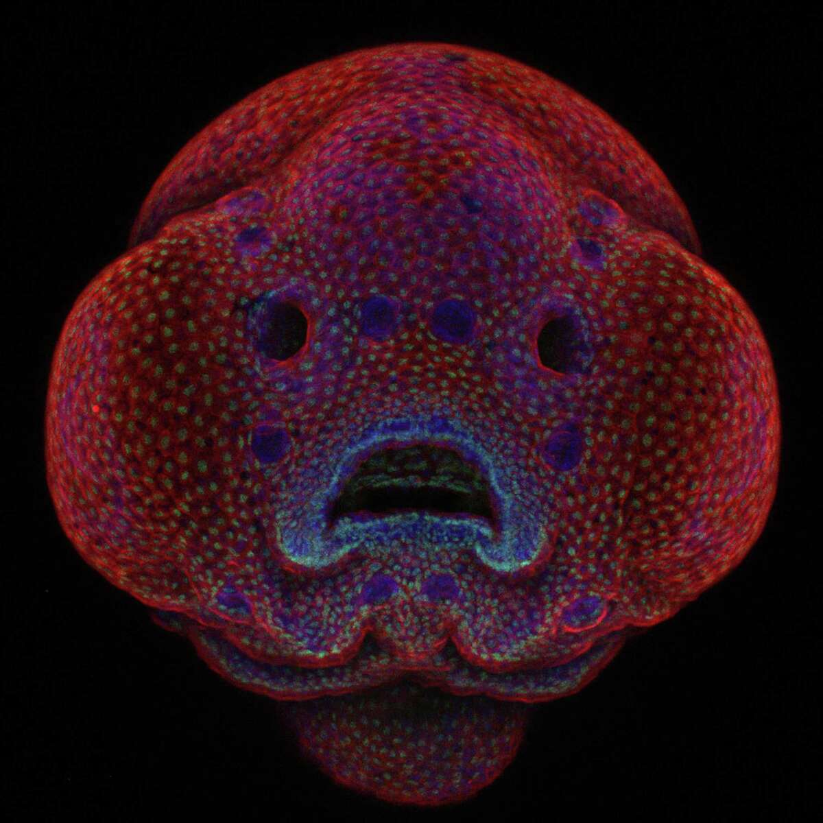 First place in the international Nikon Small World Exhibit competition was awarded to Dr. Oscar Ruiz at the University of Texas Anderson Cancer Center in Houston for his photo of a 4-day-old zebra fish embryo. It is on view at the Bruce Museum in Greenwich.