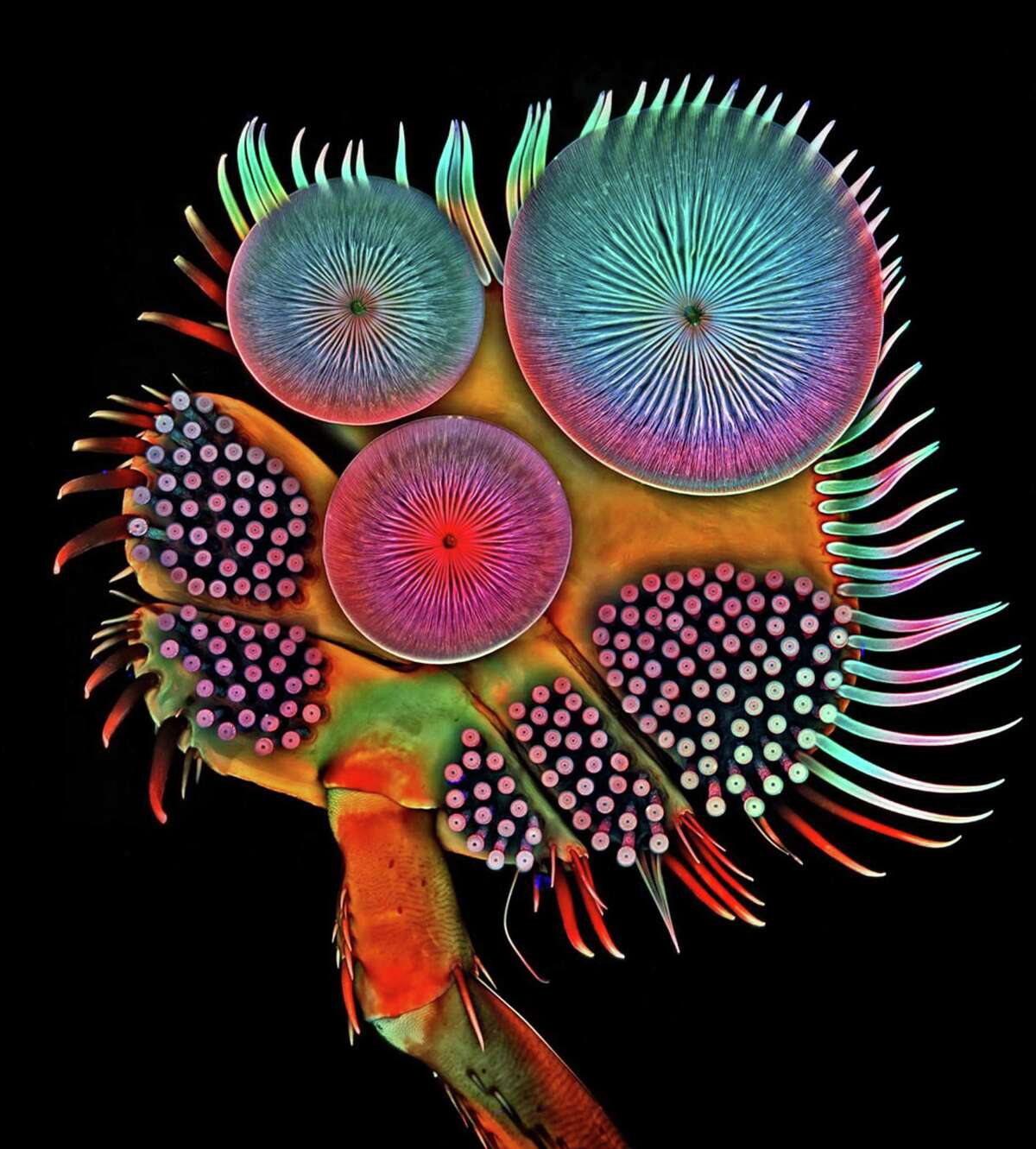 Fifth place in the international Nikon Small World Exhibit competition was awarded to Dr. Igor Siwanowicz, of the Howard Hughes Medical Institute Janelia Research Campus in Ashburn, Va., for his photo of the front foot of a male diving beetle. It is on view at the Bruce Museum in Greenwich.