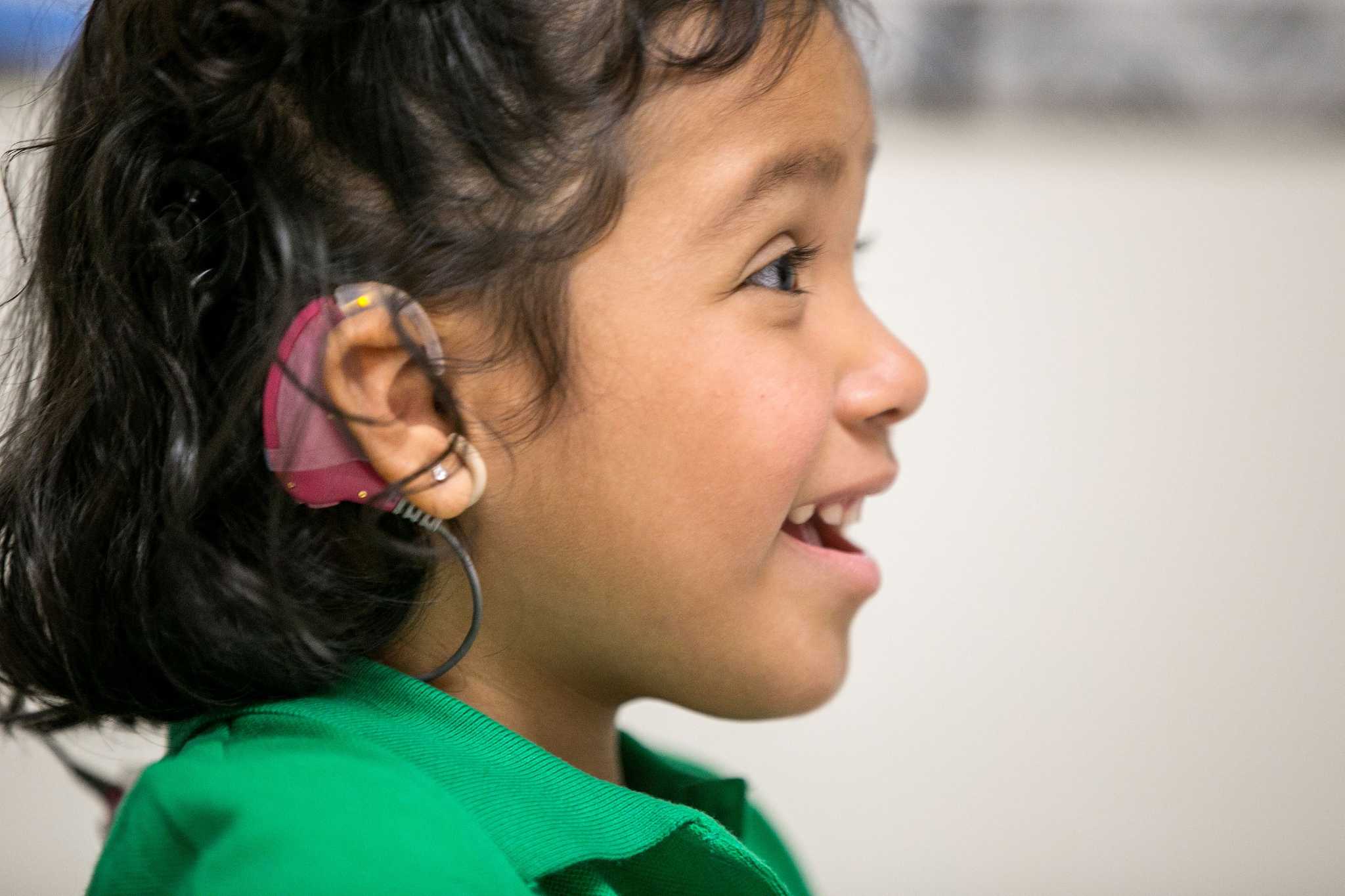 Слабослышащие лучшие. Дети с кохлеарными имплантами.. Кохлеарный имплант у ребенка. Дети с нарушением слуха.. Глухие дети с кохлеарным имплантом.