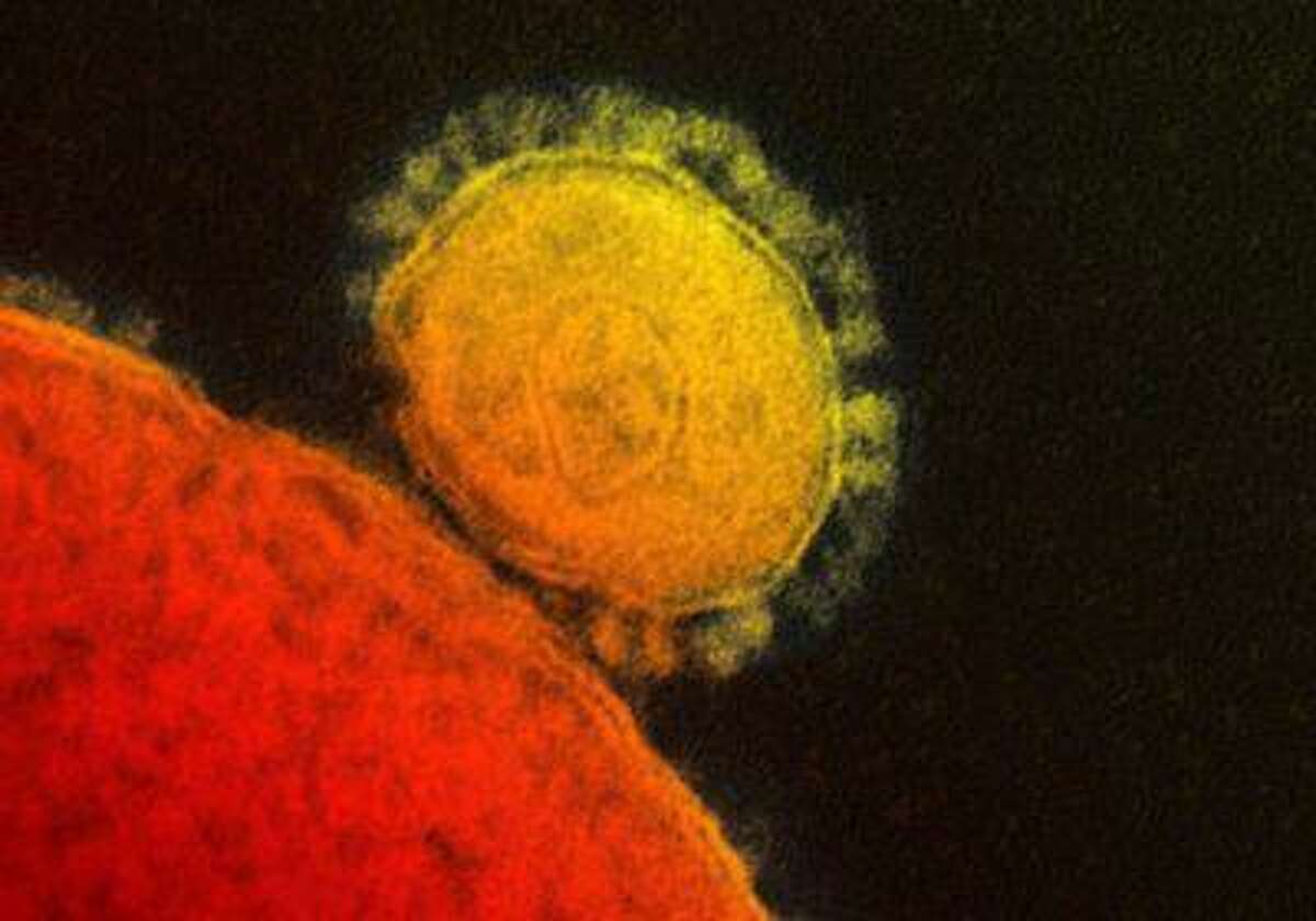 In this photo provided by the National Institute for Allergy and Infectious Diseases, a colorized transmission of the MERS coronavirus that emerged in 2012 is pictured. The week of July 8, 2013, experts from around the world will begin meeting to advise the World Health Organization on the new MERS coronavirus. (AP Photo/National Institute for Allergy and Infectious Diseases via The Canadian Press)