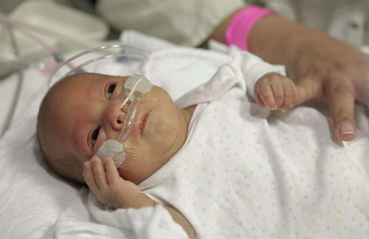 14-week-old Melinda Star Guido holds her mother's little finger while lying in an incubator at the Los Angeles County-USC Medical Center in Los Angeles, Wednesday. At birth, Melinda Star Guido tipped the scales at only 9 1/2 ounces, a tad less than the weight of two iPhone 4S. (AP Photo/Jae C. Hong)