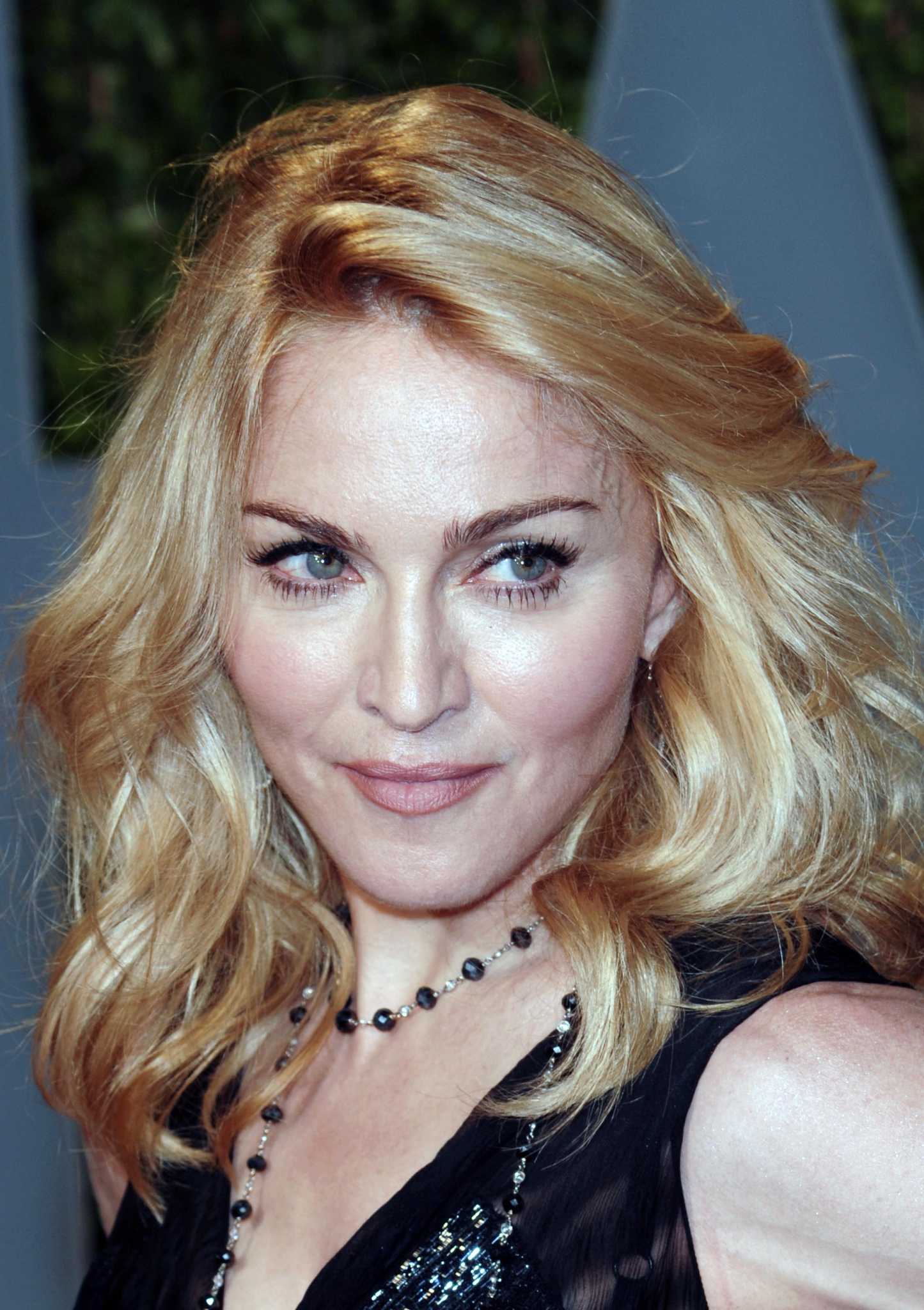 Madonna falls from horse, gets bruised up