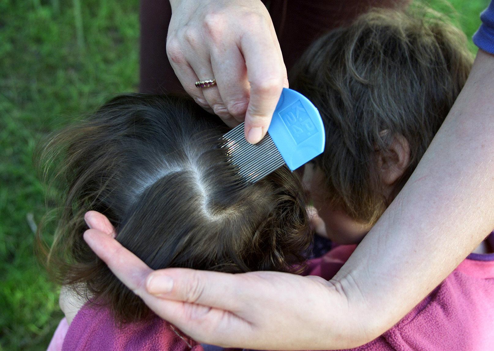 schools-must-notify-parents-if-lice-is-found-in-child-s-classroom-says-new-texas-law