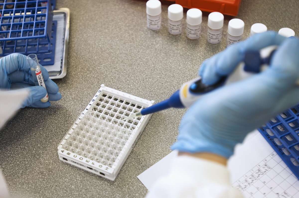 A file photo of a scientist taking sample from vials containing saliva, to be placed into test plate. (Photo by Universal Images Group via Getty Images)