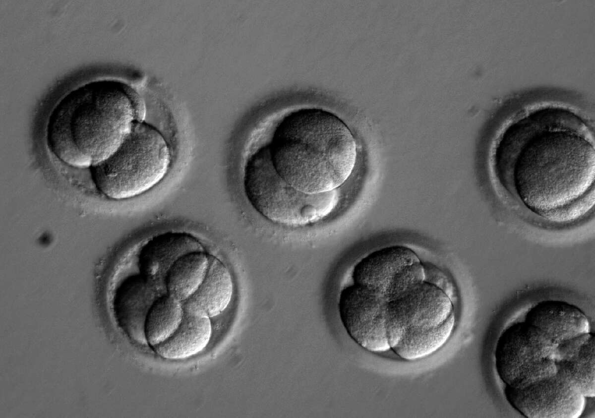 In this microscope photo provided by Oregon Health & Science University, human embryos grow in a laboratory for a few days after researchers used gene editing technology to successfully repair a heart disease-causing genetic mutation. The work, a scientific first led by researchers at Oregon Health & Science University, marks a step toward one day preventing babies from inheriting diseases that run in the family.