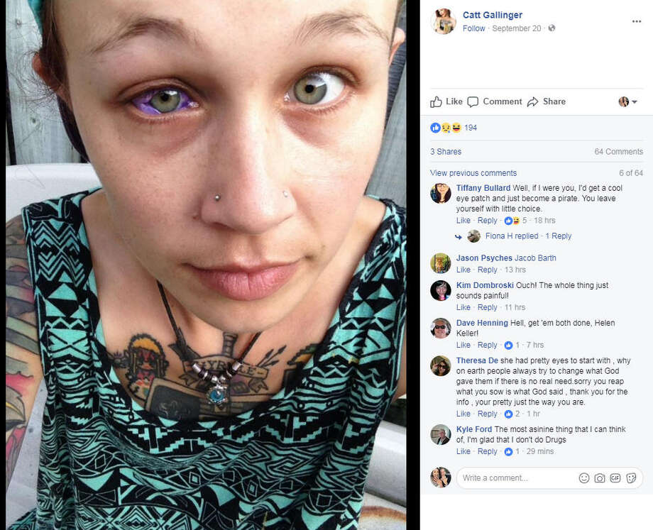 A model decided to tattoo her eyeball. She's now partially blind and in